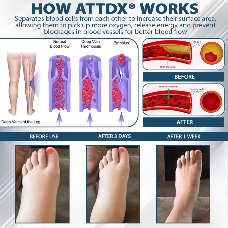 ATTDX® Black Cumin Edema Soothing Herbal Cream 2
