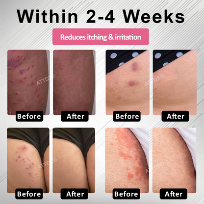 ATTDX® AgNPs Feminine Intimate Care Spray
