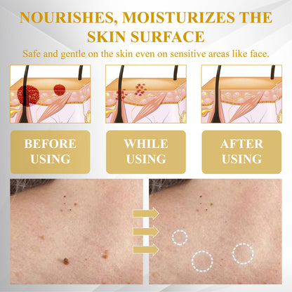 ATTDX® Advanced Fig Tag & Mole Off Capsule Serum
