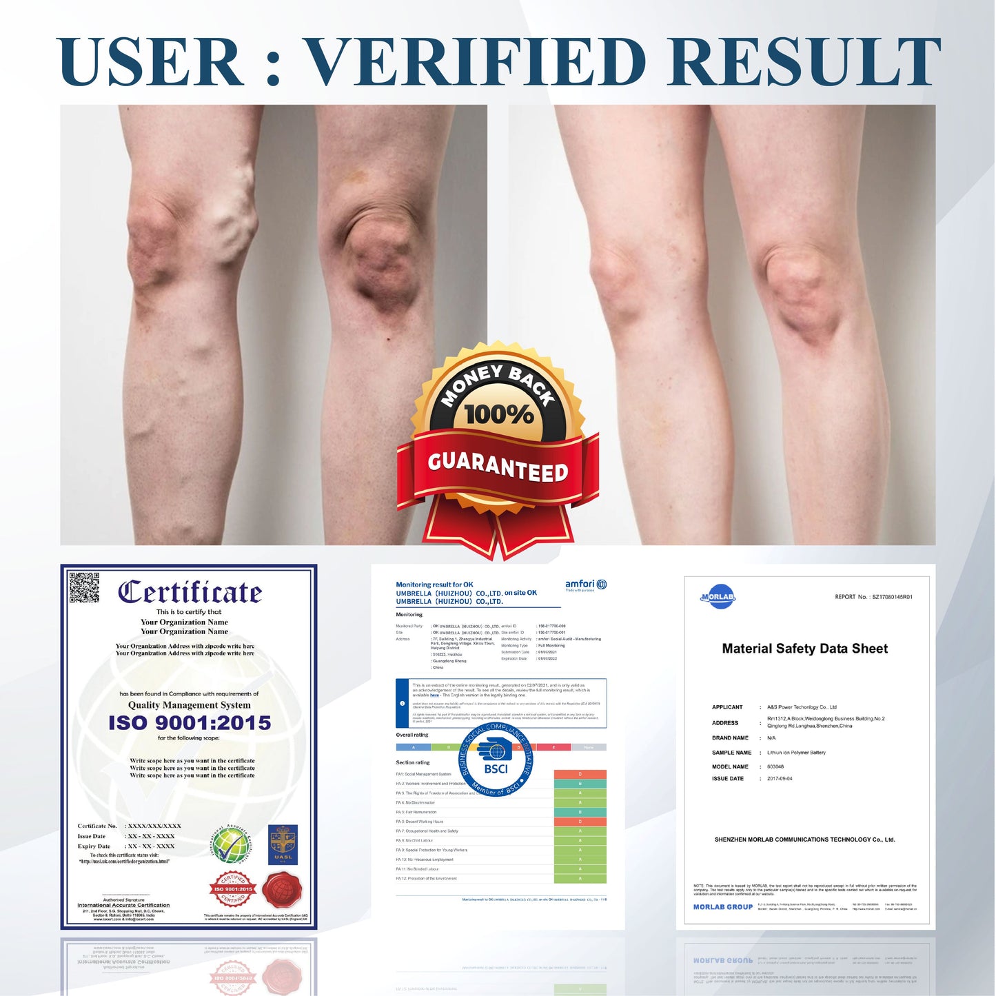 ATTDX® Black Cumin Edema Soothing Herbal Cream -👩‍⚕️Doctor-Endorsed Herbal Formula