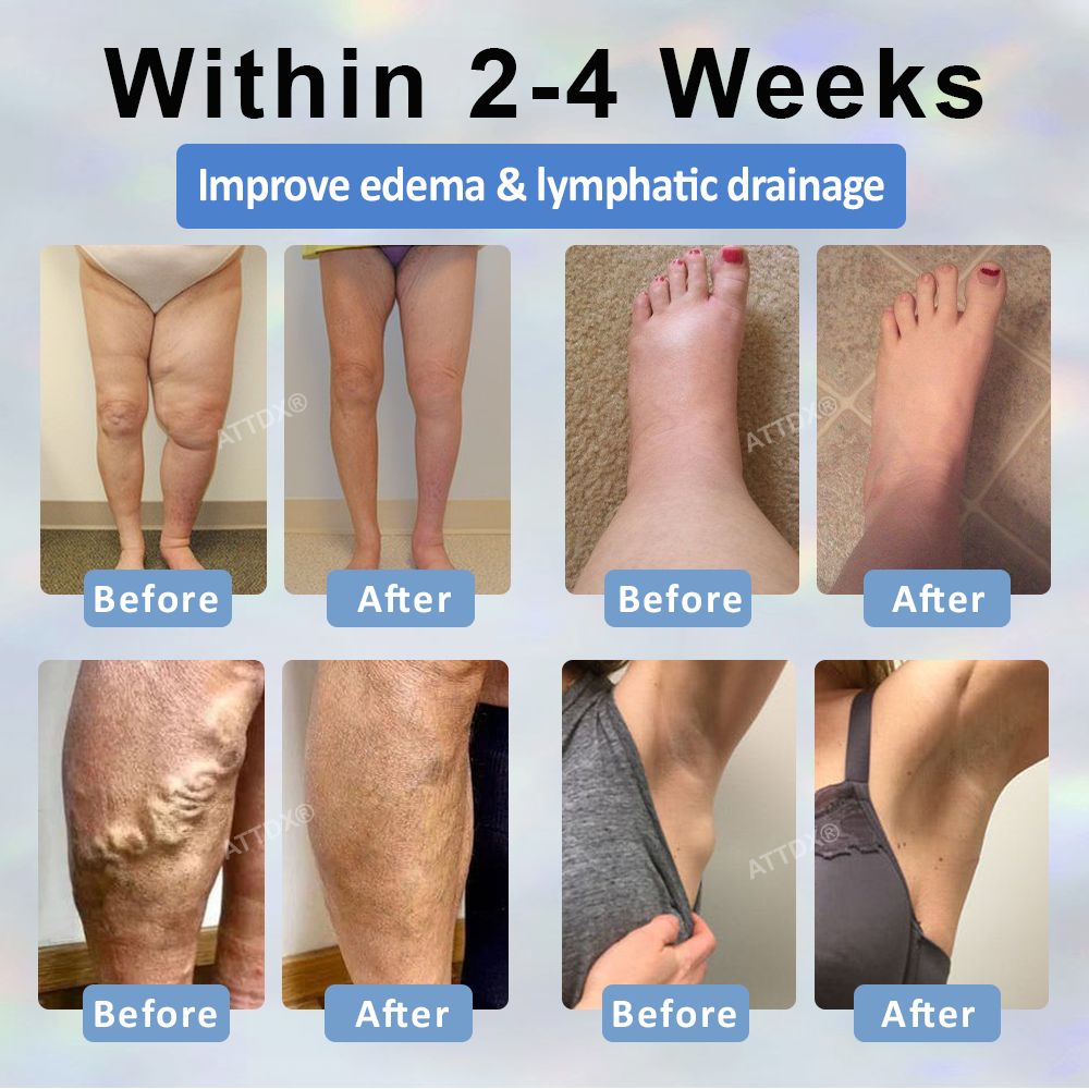 ATTDX® MicroSting Black Cumin Edema Patch