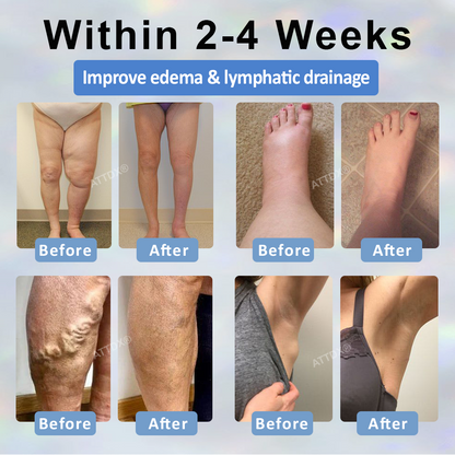 ATTDX® MicroSting Black Cumin Edema Patch
