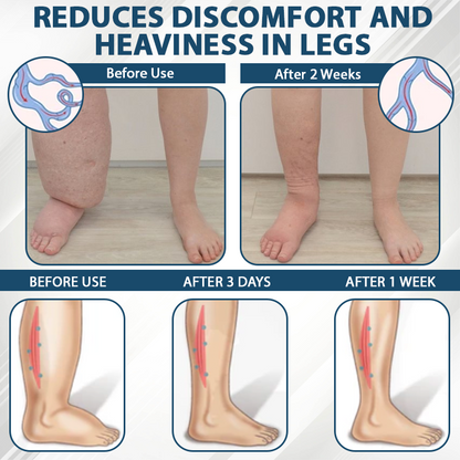 ATTDX® Black Cumin Edema Soothing Herbal Cream -👩‍⚕️Doctor-Endorsed Herbal Formula