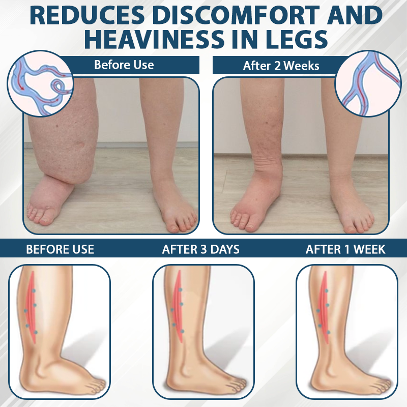 ATTDX® Black Cumin Edema Detox Herbal Cream