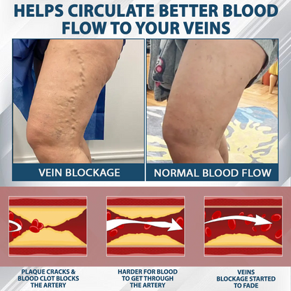 ATTDX® VenoHerb Black Cumin Edema Relief Balm