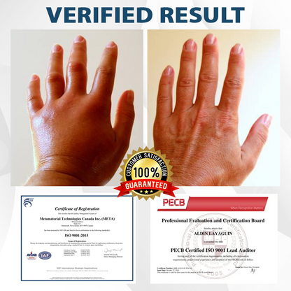 ATTDX® CuminBee Edema Relief Herbal Cream