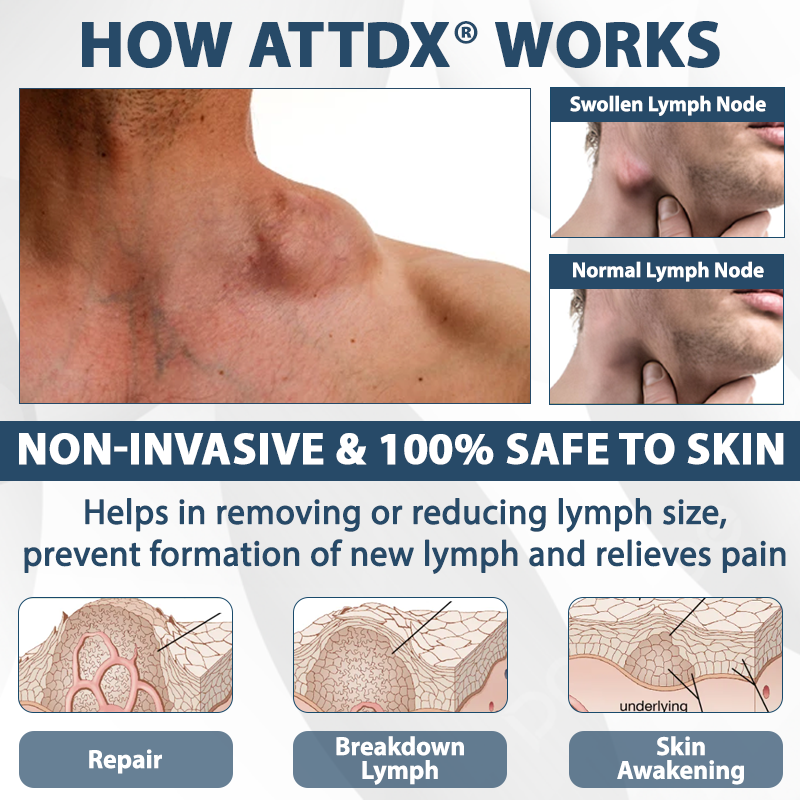 ATTDX® EdemaEase Black Cumin Therapy Cream