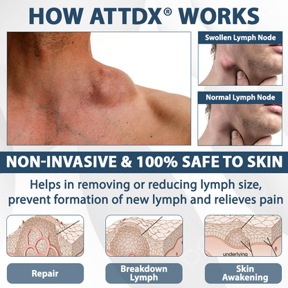 ATTDX® EdemaEase Black Cumin Therapy Cream