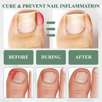 ATTDX® FungaGuard Nail Renewal Herbal Spray