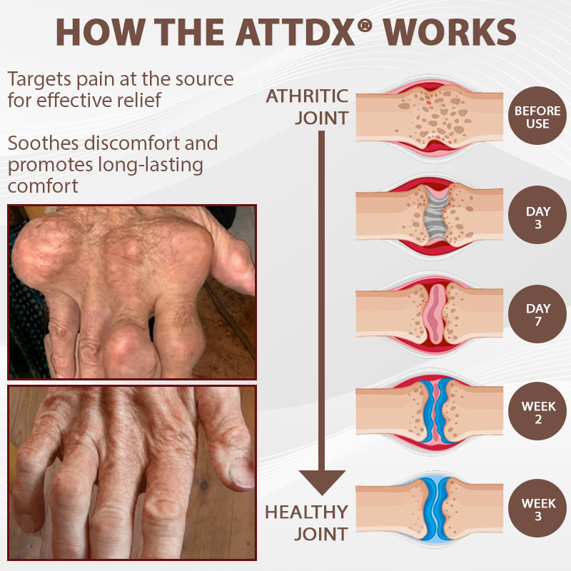 ATTDX® ArthriHeal Black Cumin Bone Relief Cream