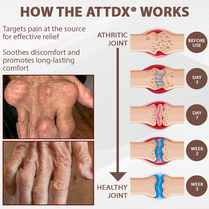 ATTDX® ArthriHeal Black Cumin Bone Relief Cream