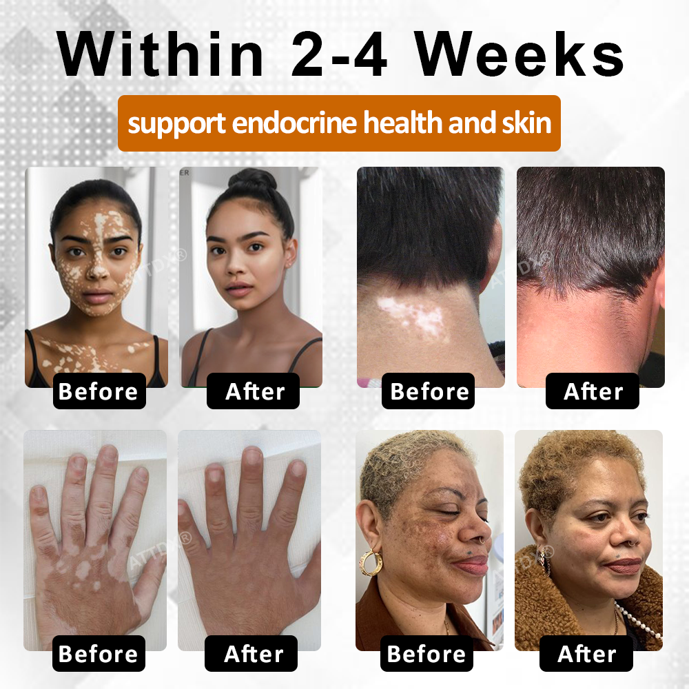 ATTDX® MelanoCare Skin Rebalancing VitiBee Cream