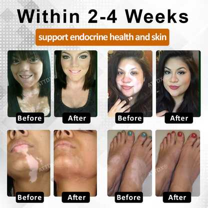 ATTDX® MelanoCare Skin Rebalancing VitiBee Cream