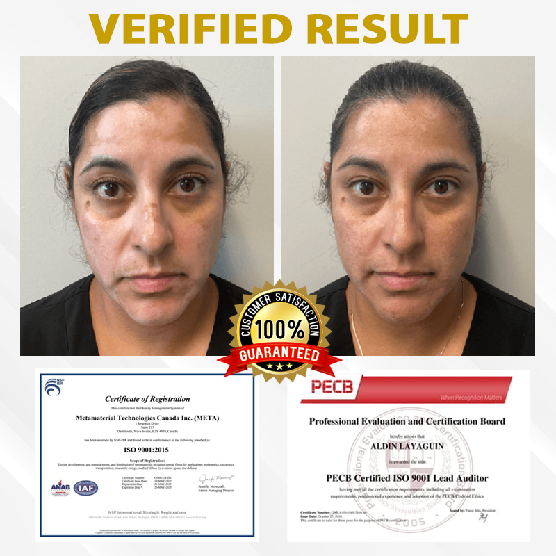 ATTDX® MelanoCare Skin Rebalancing VitiBee Cream