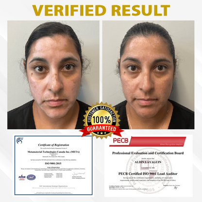 ATTDX® MelanoCare Skin Rebalancing VitiBee Cream