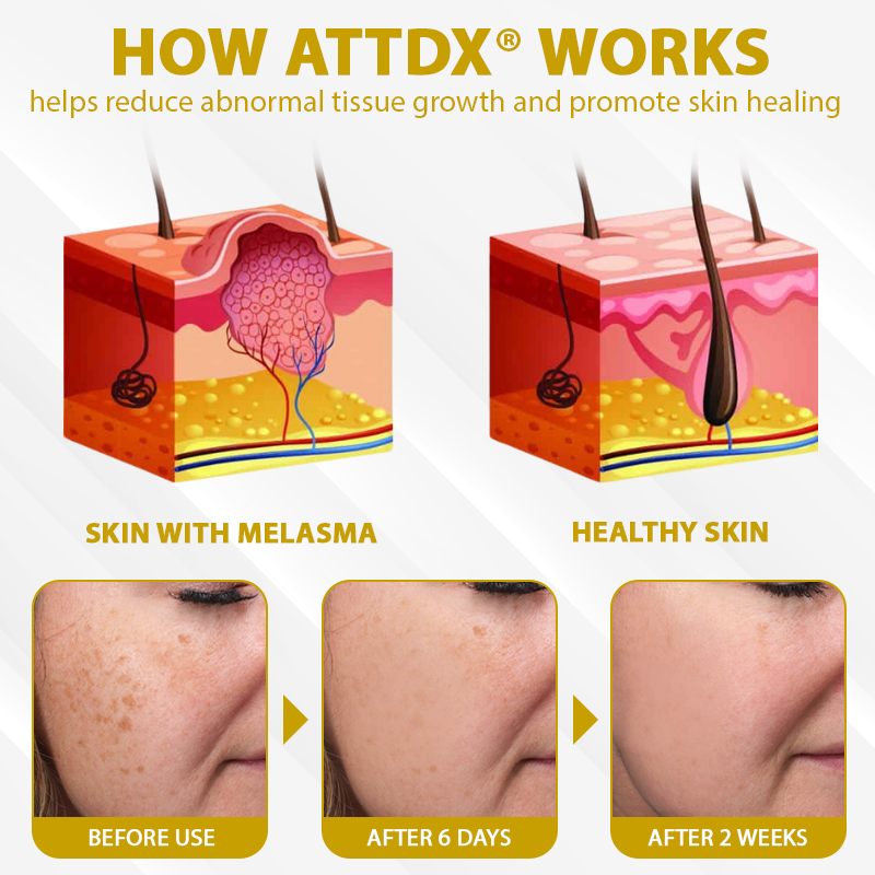 ATTDX® MelanoCare Skin Rebalancing VitiBee Cream