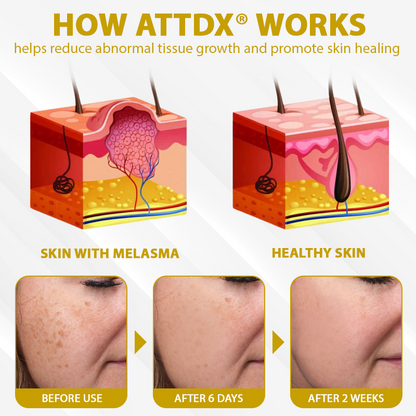 ATTDX® MelanoCare Skin Rebalancing VitiBee Cream
