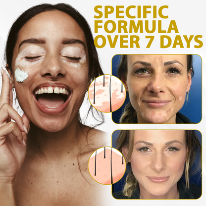 ATTDX® MelanoCare Skin Rebalancing VitiBee Cream