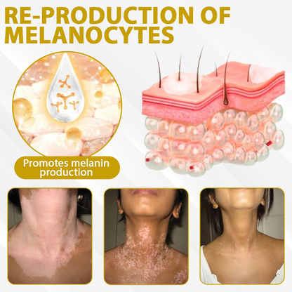 ATTDX® MelanoCare Skin Rebalancing VitiBee Cream