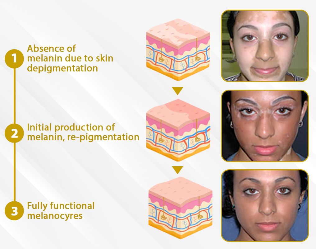 ATTDX® MelanoCare Skin Rebalancing VitiBee Cream