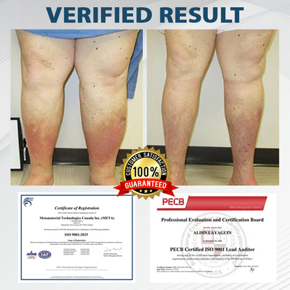 ATTDX® MicroSting Black Cumin Edema Patch