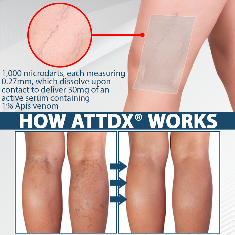 ATTDX® MicroSting Black Cumin Edema Patch