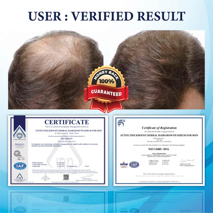ThickBoost Herbal HairGrowth Serum for Men