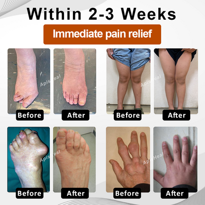 ATTDX® InflameHeal Black Cumin Bone Relief Gel