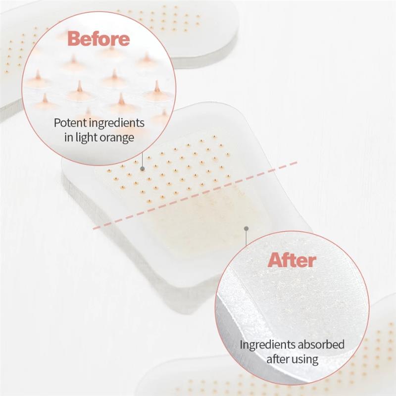 ATTDX® MicroSting Black Cumin Edema Patch